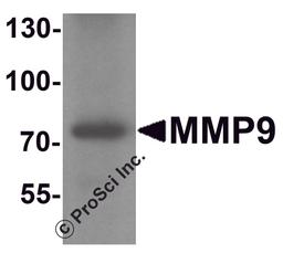 Western blot analysis of MMP9 in mouse lung tissue lysate with MMP9 antibody at 1 μg/ml.