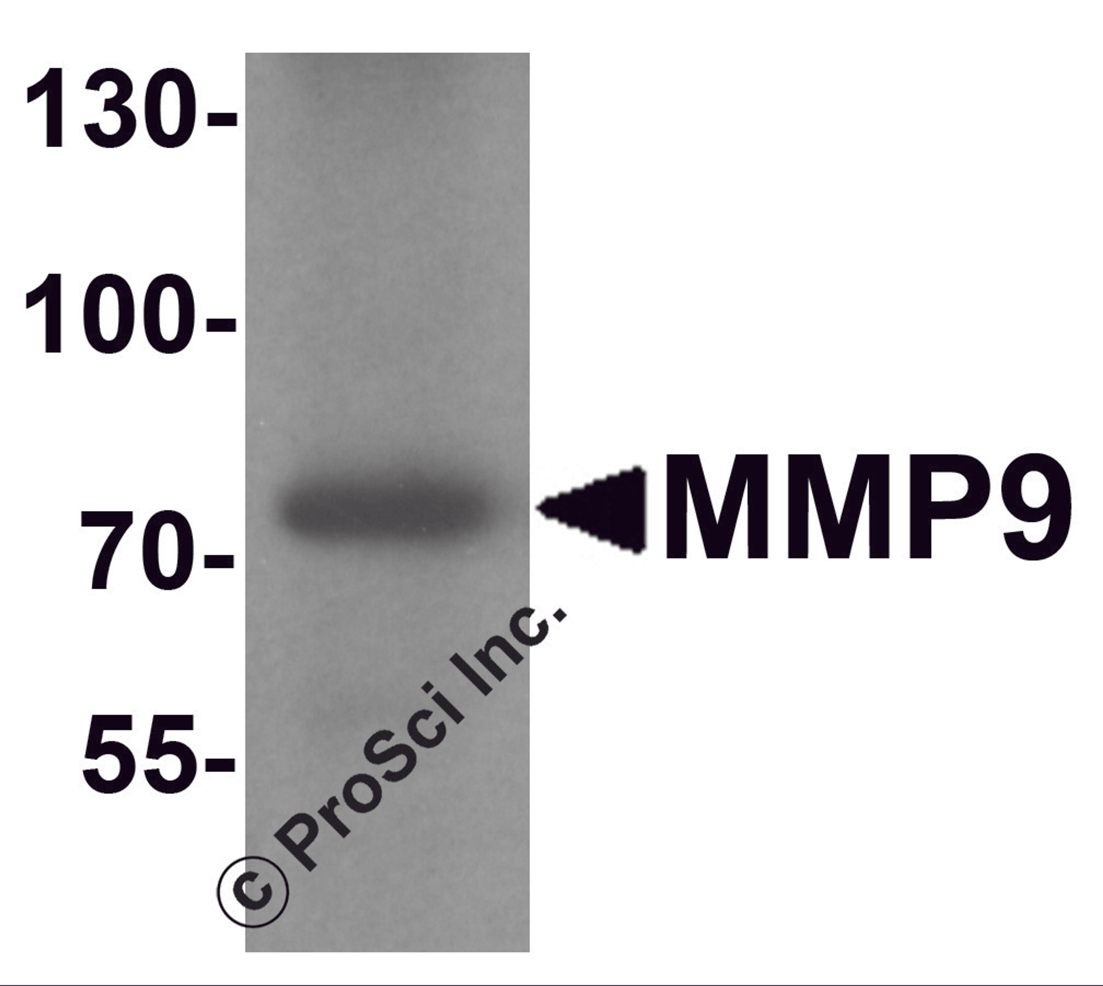 Western blot analysis of MMP9 in mouse lung tissue lysate with MMP9 antibody at 1 μg/ml.