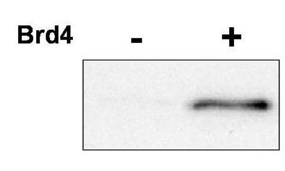 Western blot analysis of regulatory cyclin T1 subunit, was incubated with ATP in the presence or absence of Brd4, a protein known to induce CDK9 phosphorylation at T29 using CDK9 (phospho-T29) antibody