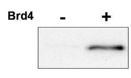 Western blot analysis of regulatory cyclin T1 subunit, was incubated with ATP in the presence or absence of Brd4, a protein known to induce CDK9 phosphorylation at T29 using CDK9 (phospho-T29) antibody