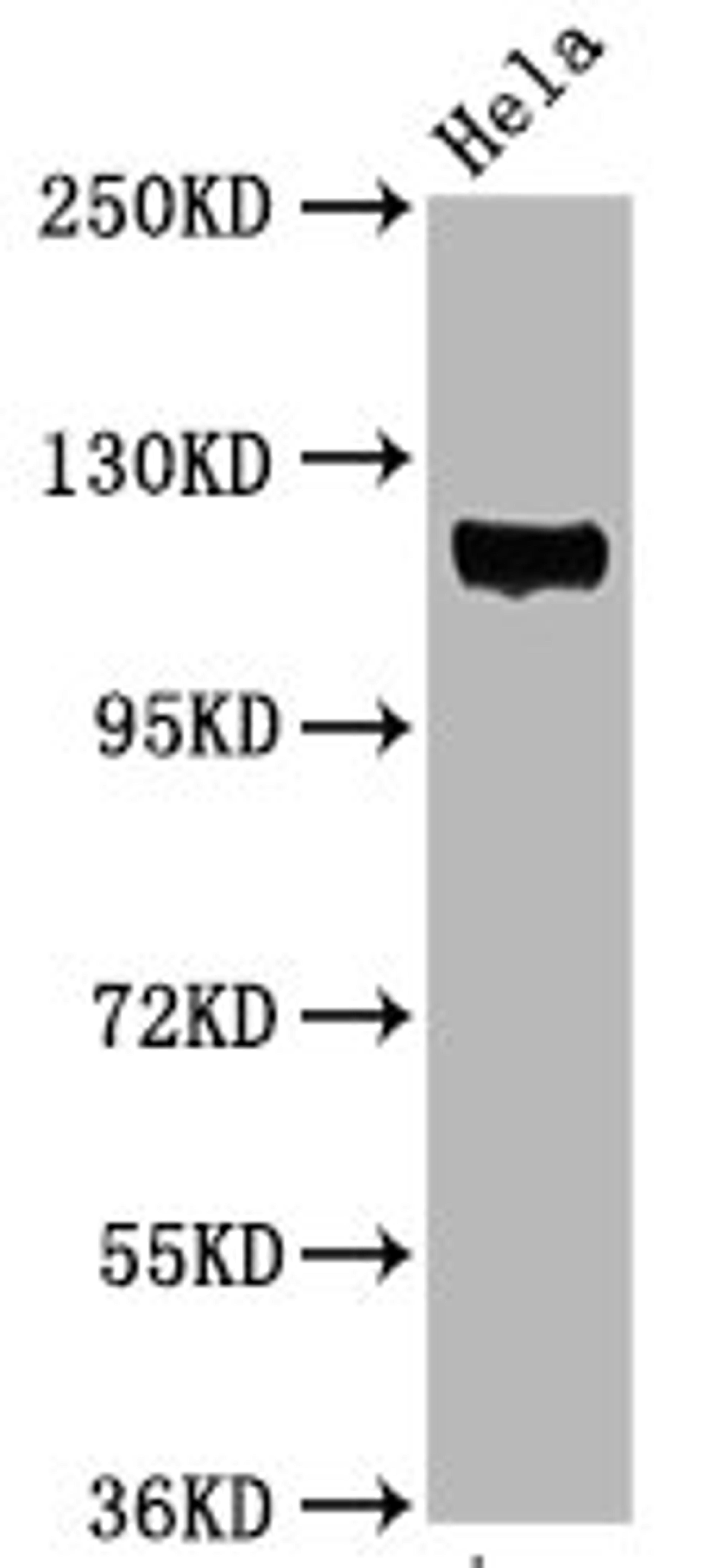 Western Blot. Positive WB detected in Hela whole cell lysate. All lanes Phospho-PTK2 antibody at 3.05μg/ml. Secondary. Goat polyclonal to rabbit IgG at 1/50000 dilution. Predicted band size: 119 KDa. Observed band size: 119 KDa. 