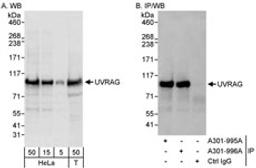 Detection of human UVRAG by western blot and immunoprecipitation.