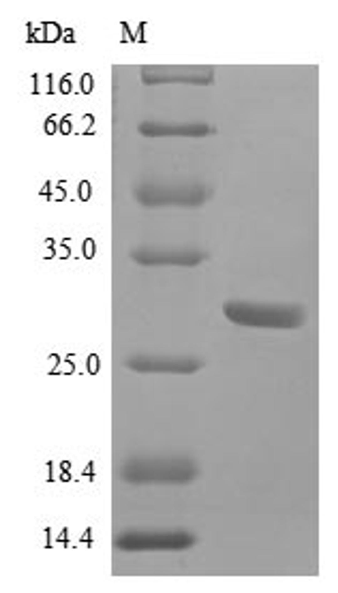 (Tris-Glycine gel) Discontinuous SDS-PAGE (reduced) with 5% enrichment gel and 15% separation gel.