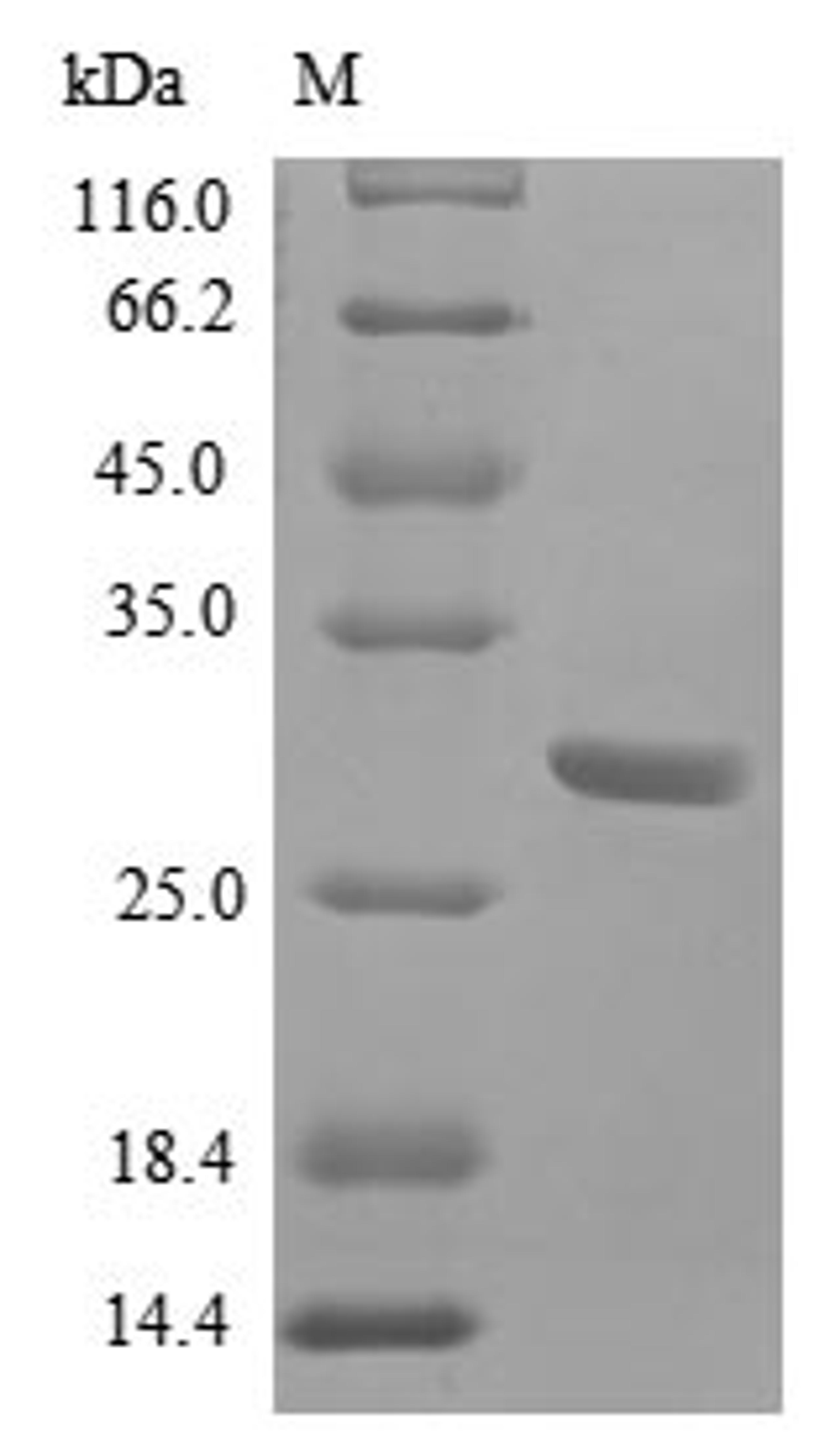 (Tris-Glycine gel) Discontinuous SDS-PAGE (reduced) with 5% enrichment gel and 15% separation gel.