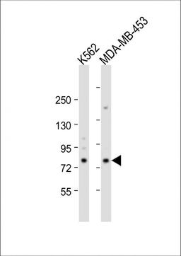 Western Blot at 1:2000 dilution Lane 1: K562 whole cell lysate Lane 2: MDA-MB-453 whole cell lysate Lysates/proteins at 20 ug per lane.