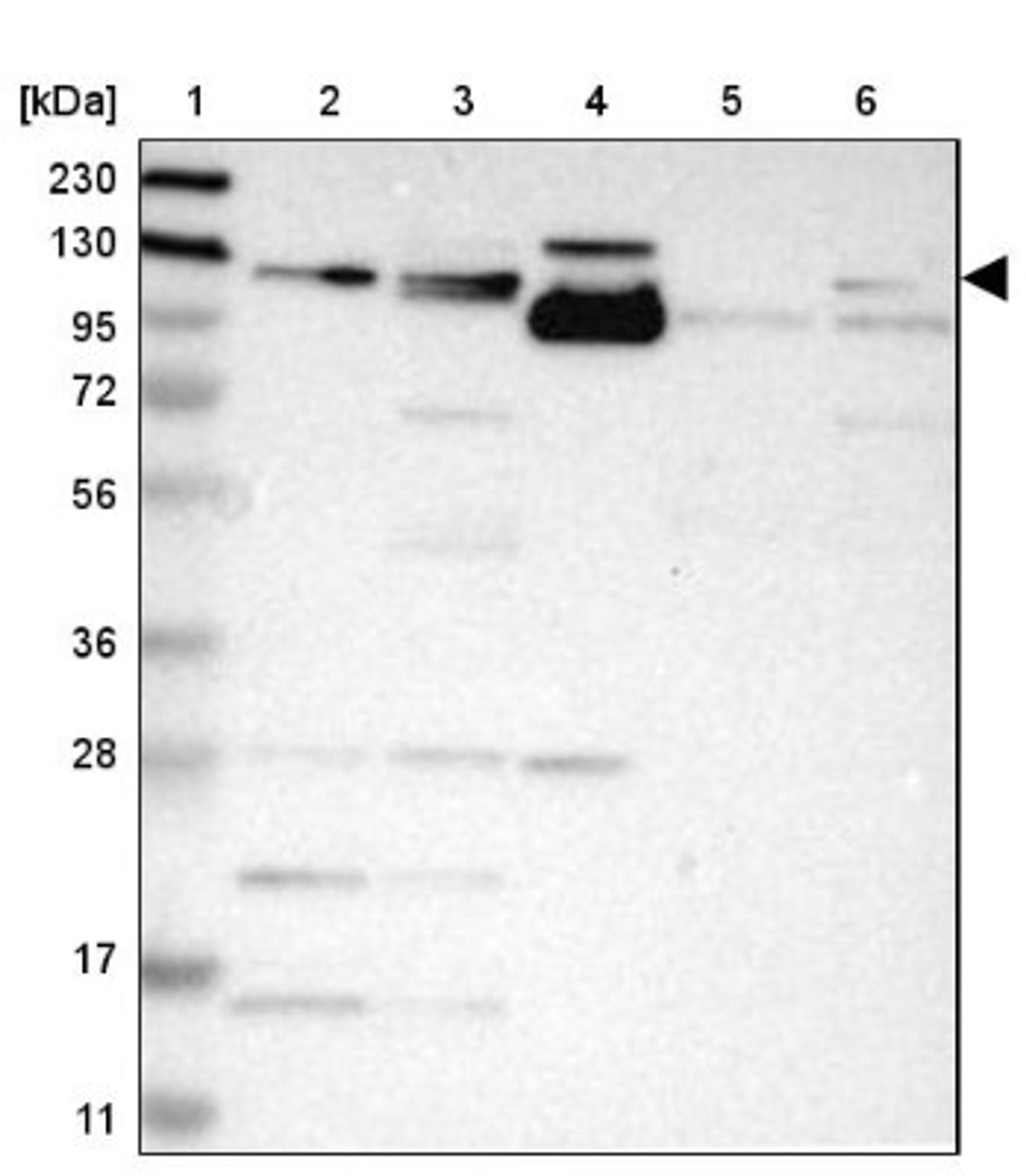 Western Blot: ITGA7 Antibody [NBP1-86118] - Lane 1: Marker [kDa] 230, 130, 95, 72, 56, 36, 28, 17, 11<br/>Lane 2: Human cell line RT-4<br/>Lane 3: Human cell line U-251MG sp<br/>Lane 4: Human plasma (IgG/HSA depleted)<br/>Lane 5: Human liver tissue<br/>Lane 6: Human tonsil tissue