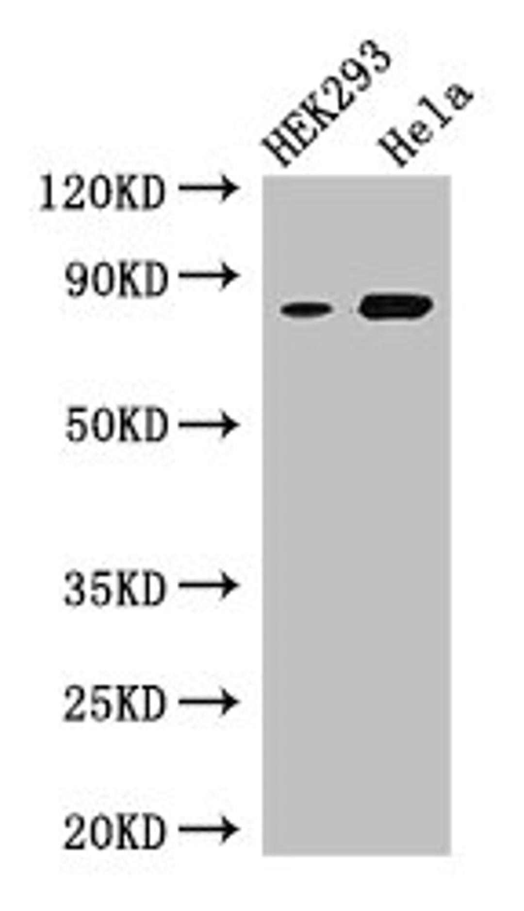 Western Blot. Positive WB detected in: HEK293 whole cell lysate, Hela whole cell lysate. All lanes: MELTF antibody at 3µg/ml. Secondary. Goat polyclonal to rabbit IgG at 1/50000 dilution. Predicted band size: 81, 33 kDa. Observed band size: 81 kDa