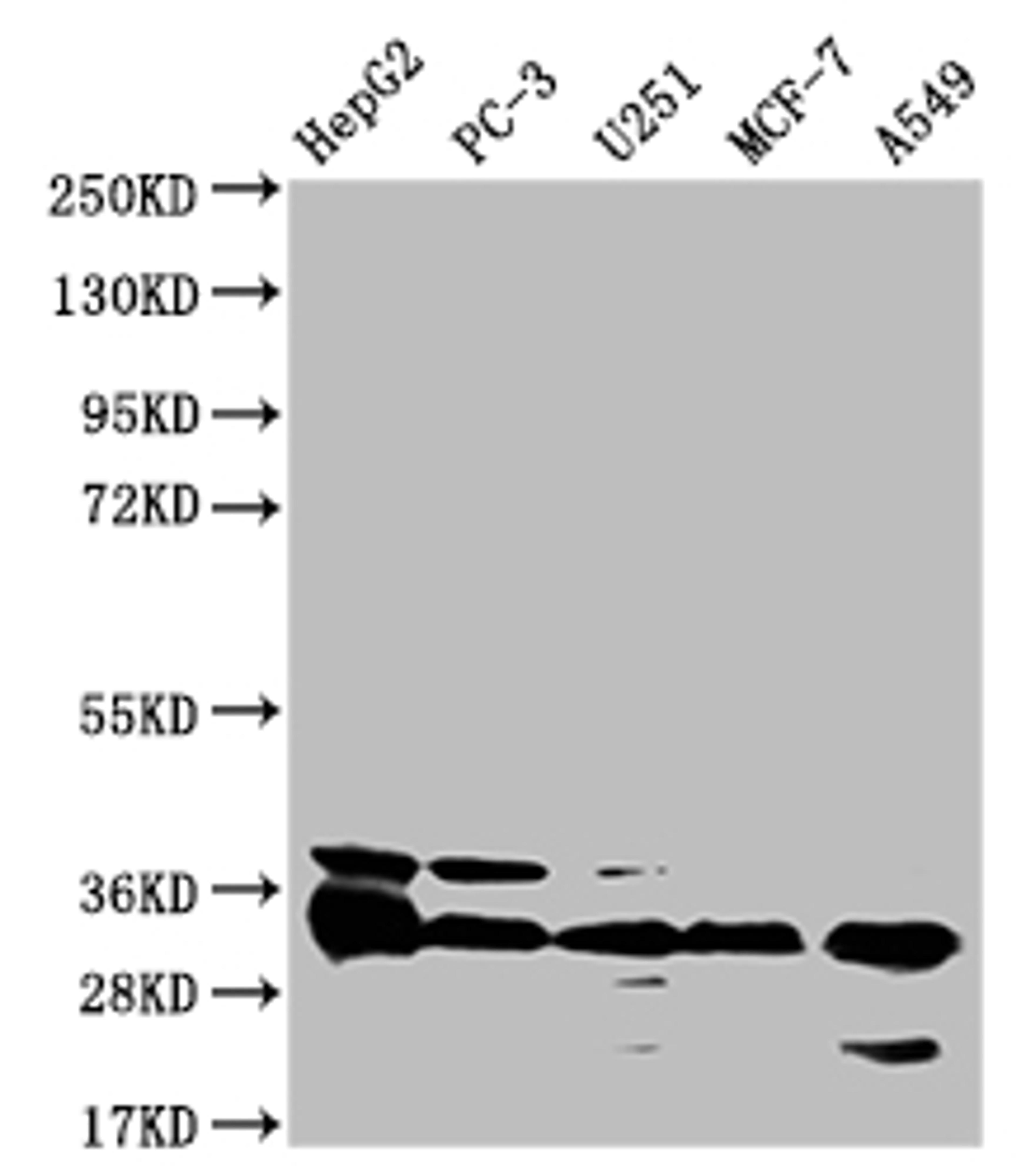 Western Blot. Positive WB detected in: HepG2 whole cell lysate, PC-3 whole cell lysate, U251 whole cell lysate, MCF-7 whole cell lysate, A549 whole cell lysate. All lanes: TMEM192 antibody at 1:1000. Secondary. Goat polyclonal to rabbit IgG at 1/50000 dilution. Predicted band size: 31 kDa. Observed band size: 31 kDa. 