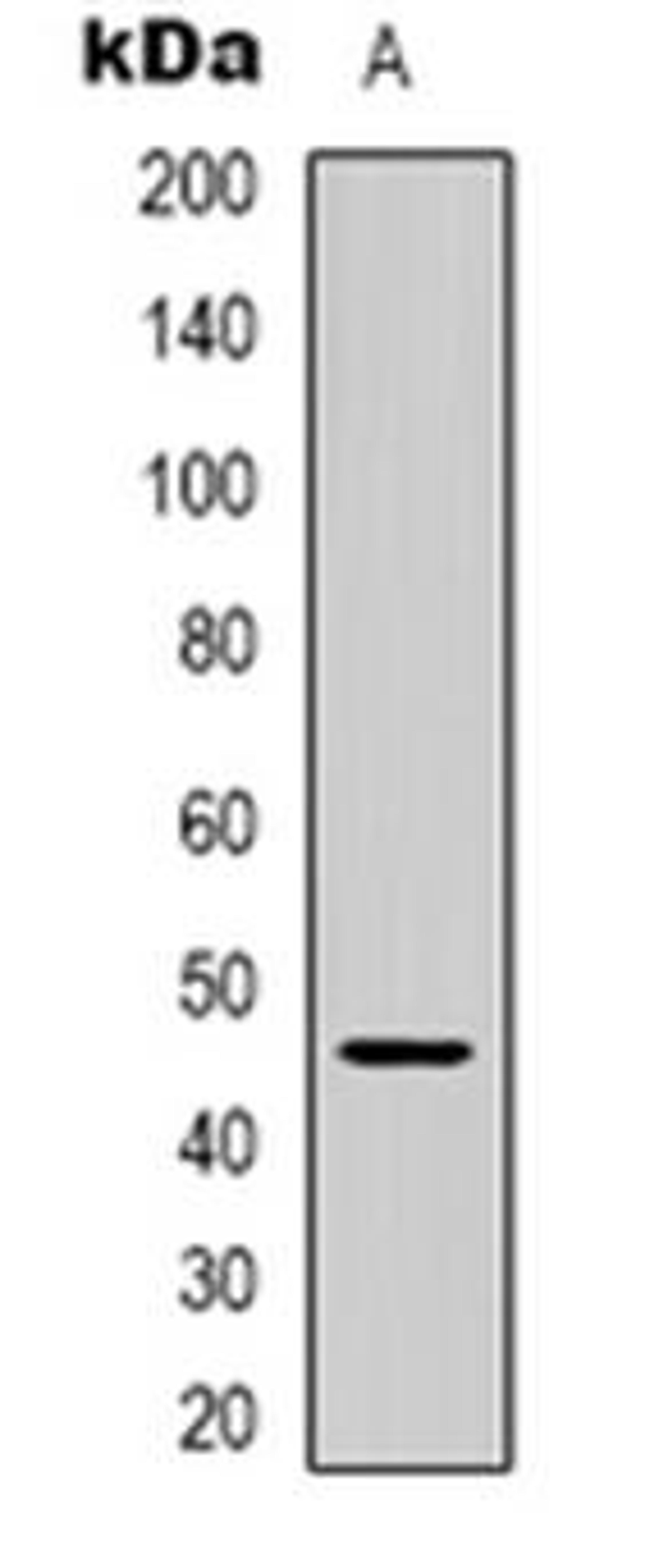 Western blot analysis of GPR172A expression in human brain (Lane 1) whole cell lysates using SLC52A2 antibody