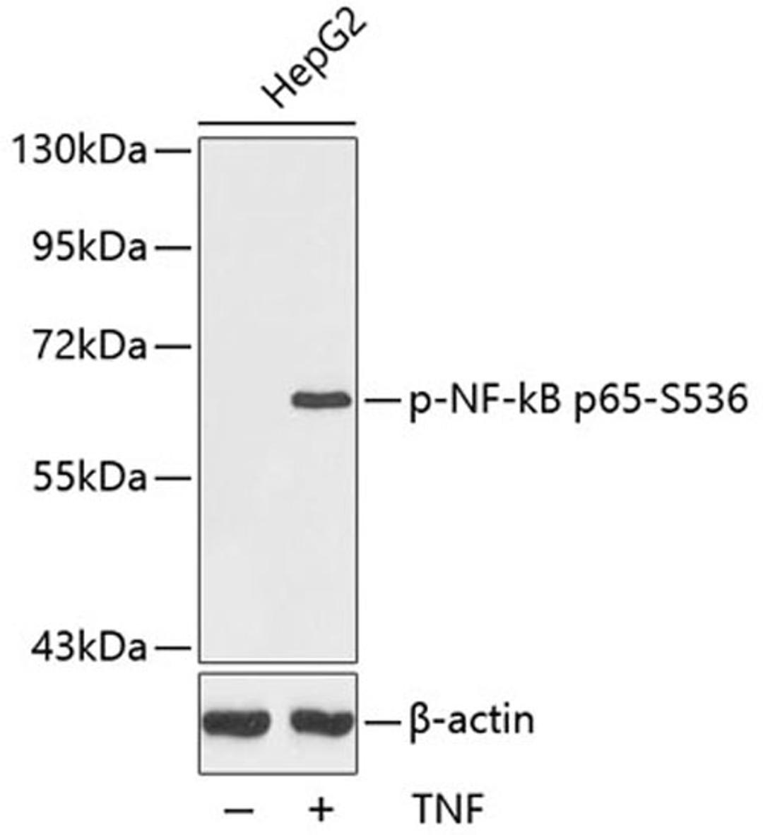 Western blot - Phospho-NF-kB p65-S536 antibody (AP0124)