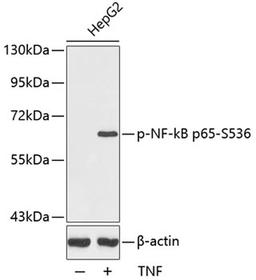 Western blot - Phospho-NF-kB p65-S536 antibody (AP0124)