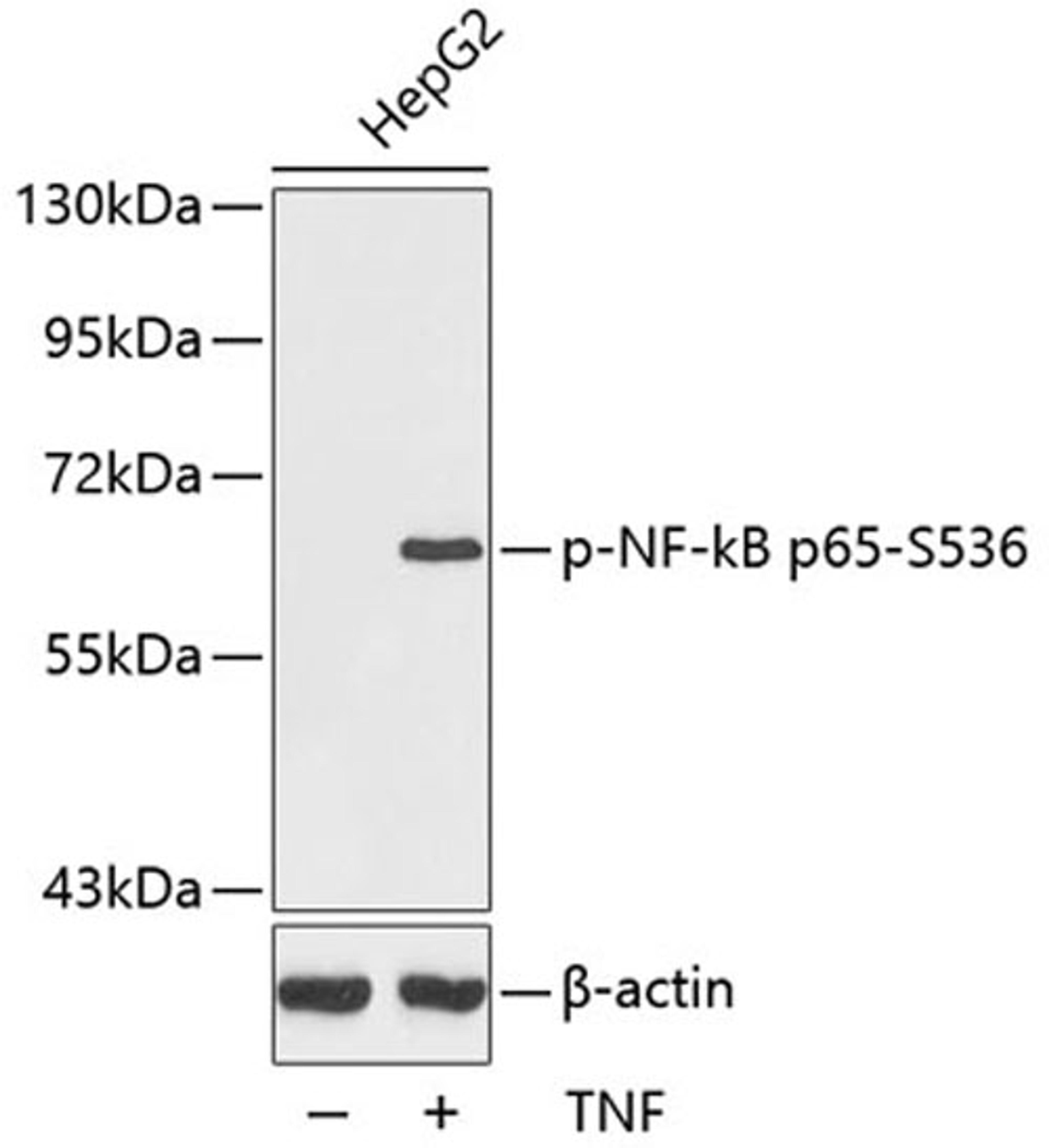 Western blot - Phospho-NF-kB p65-S536 antibody (AP0124)