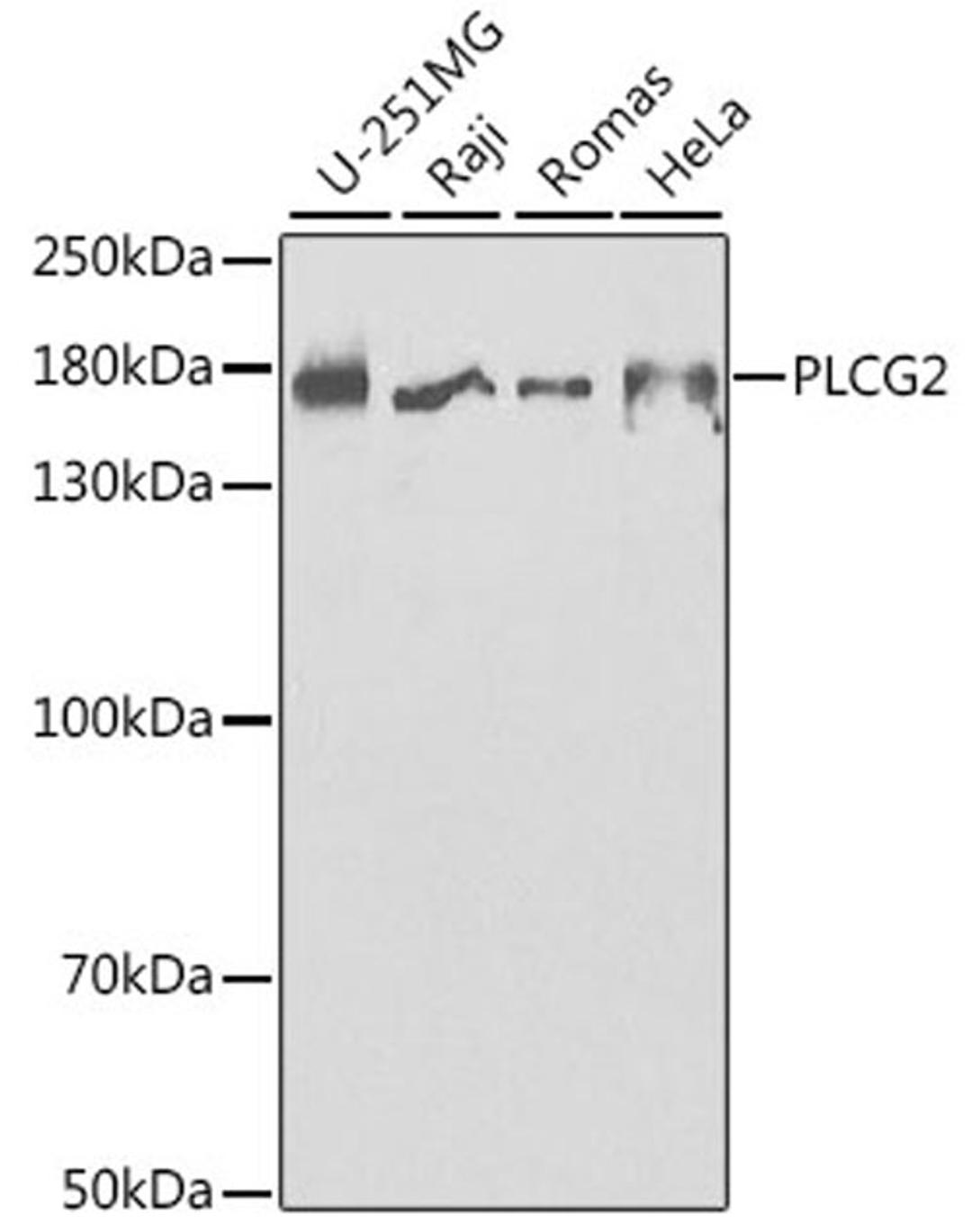 Western blot - PLCG2 antibody (A2182)