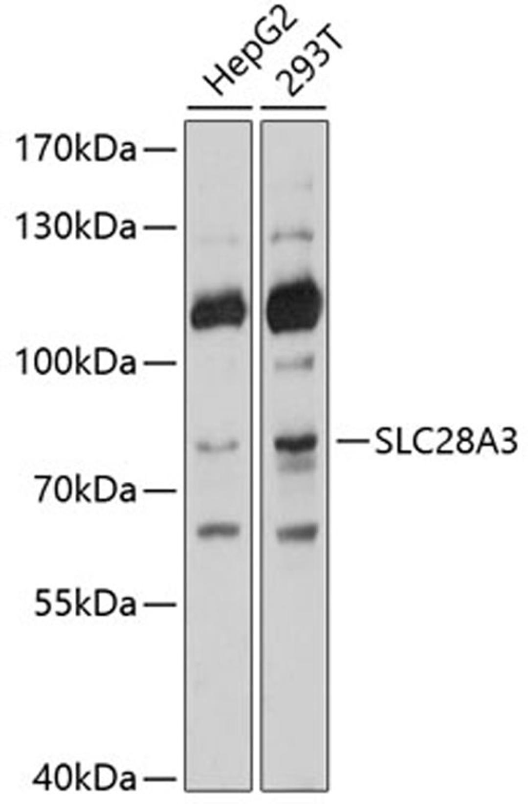 Western blot - SLC28A3 antibody (A10320)