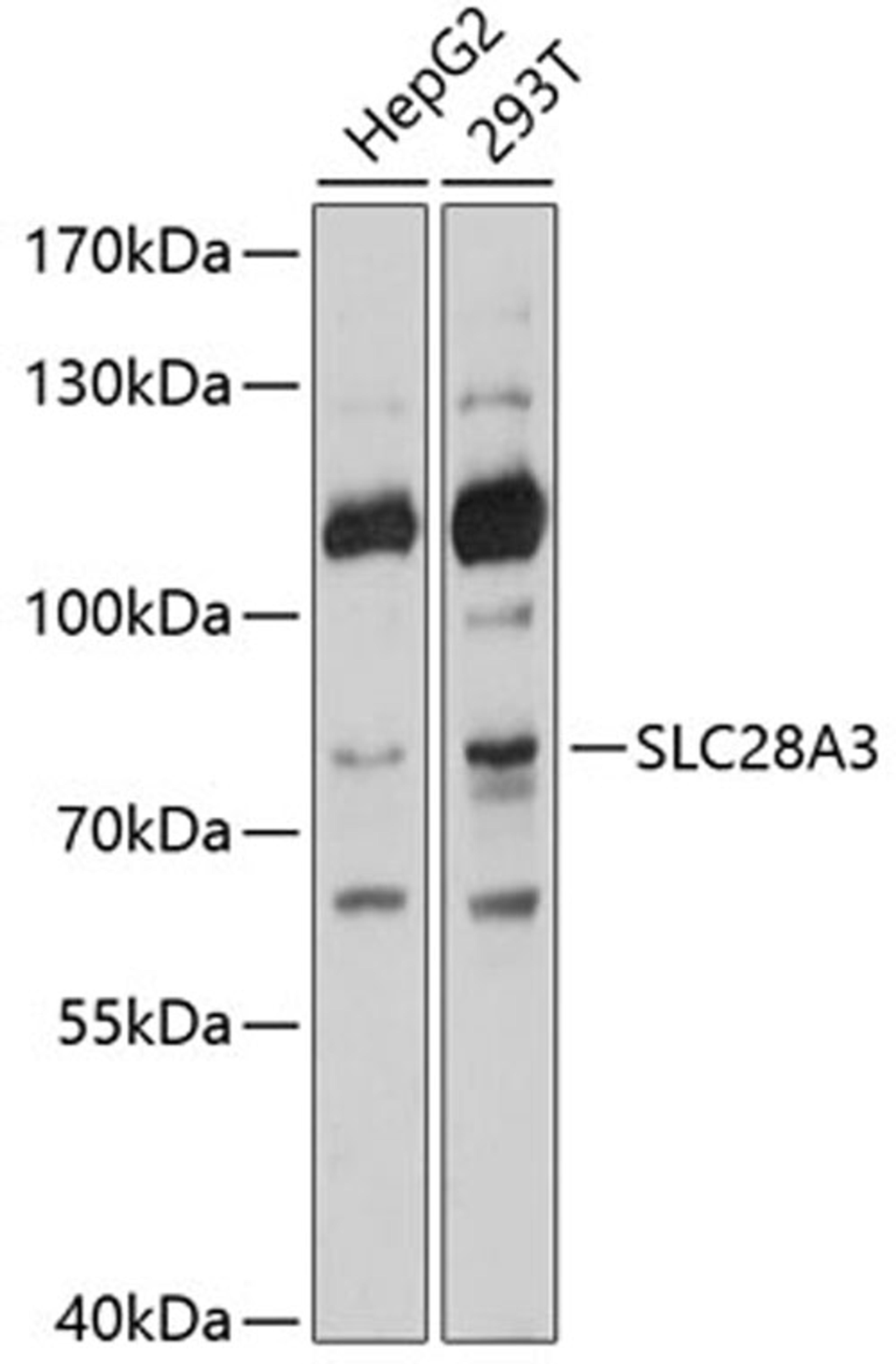 Western blot - SLC28A3 antibody (A10320)