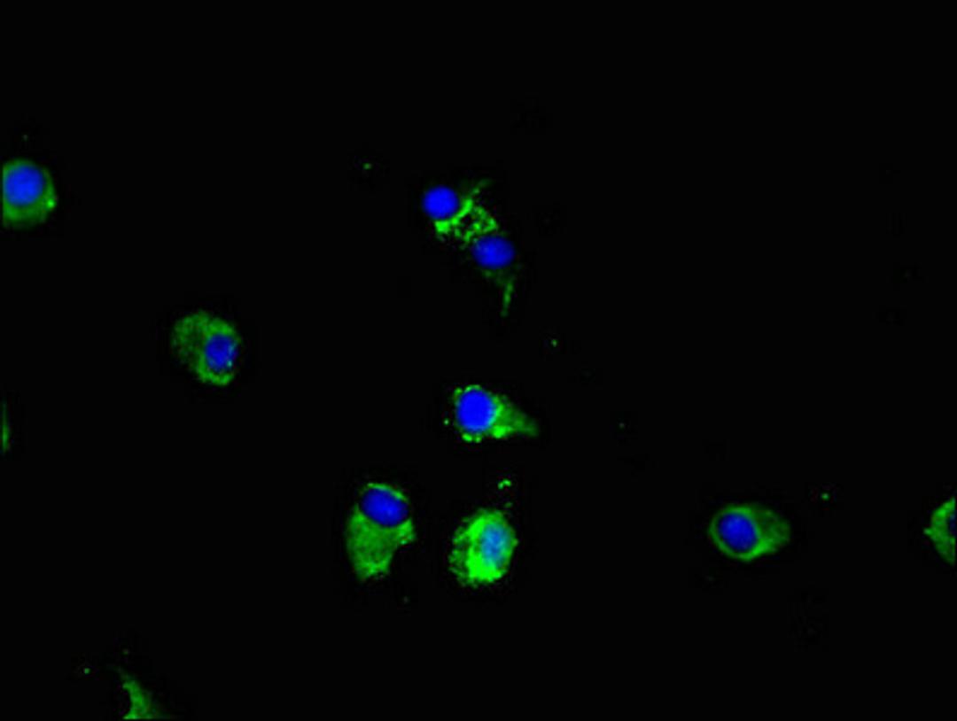Immunofluorescent analysis of Hela cells using CSB-PA767205LA01HU at dilution of 1:100 and Alexa Fluor 488-congugated AffiniPure Goat Anti-Rabbit IgG(H+L)