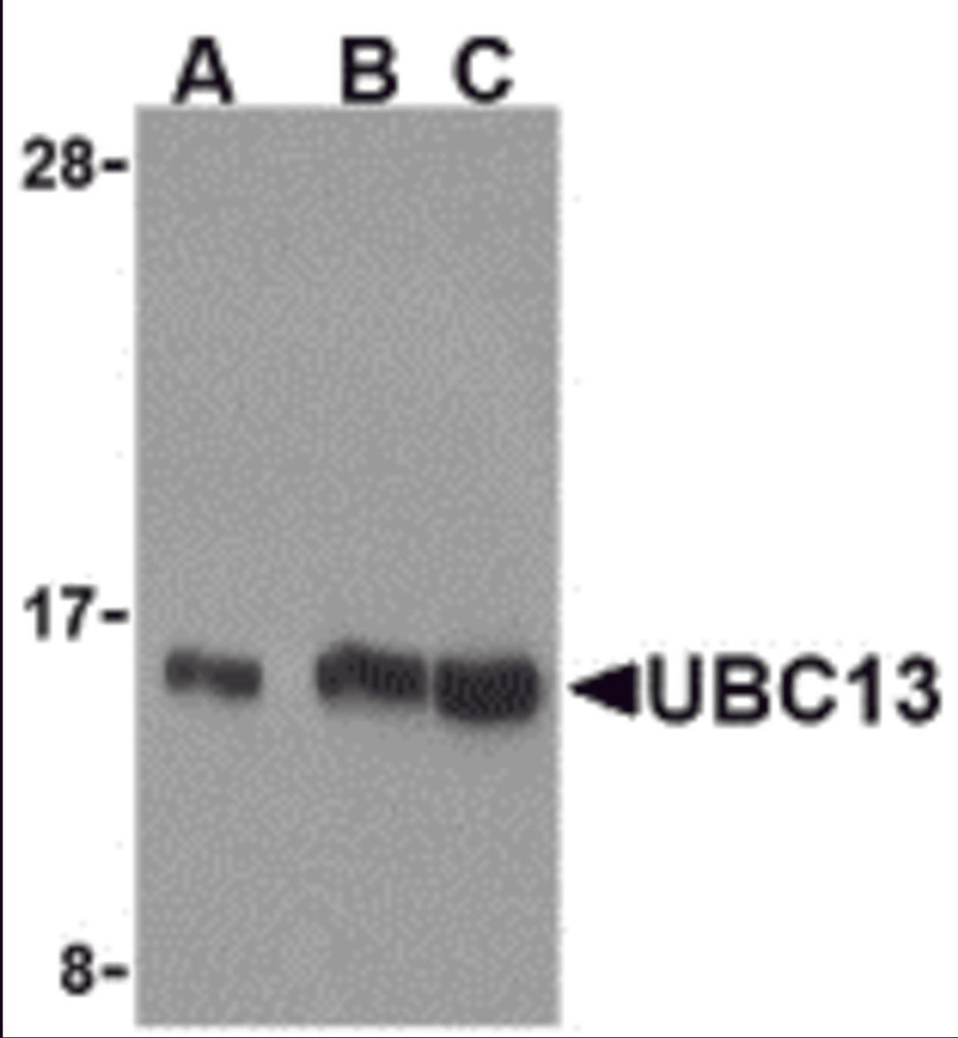 Western blot analysis of UBC13 in human small intestine cell lysates with UBC13 antibody at (A) 0.5, (B) 1, and (C) 2 &#956;g/mL. 