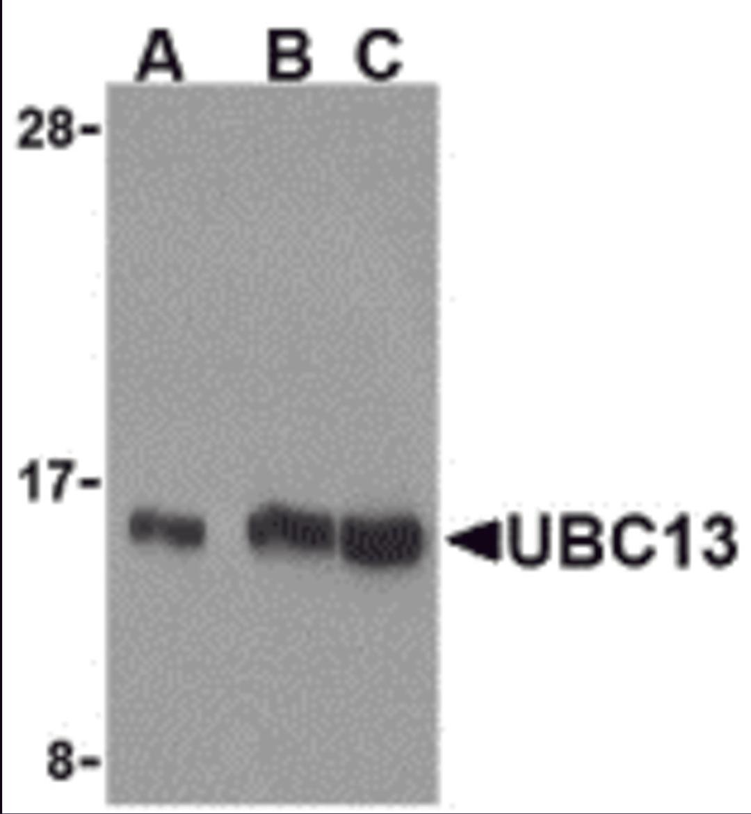 Western blot analysis of UBC13 in human small intestine cell lysates with UBC13 antibody at (A) 0.5, (B) 1, and (C) 2 μg/mL.