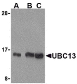 Western blot analysis of UBC13 in human small intestine cell lysates with UBC13 antibody at (A) 0.5, (B) 1, and (C) 2 μg/mL.