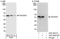 Detection of human PACSIN3 by western blot and immunoprecipitation.