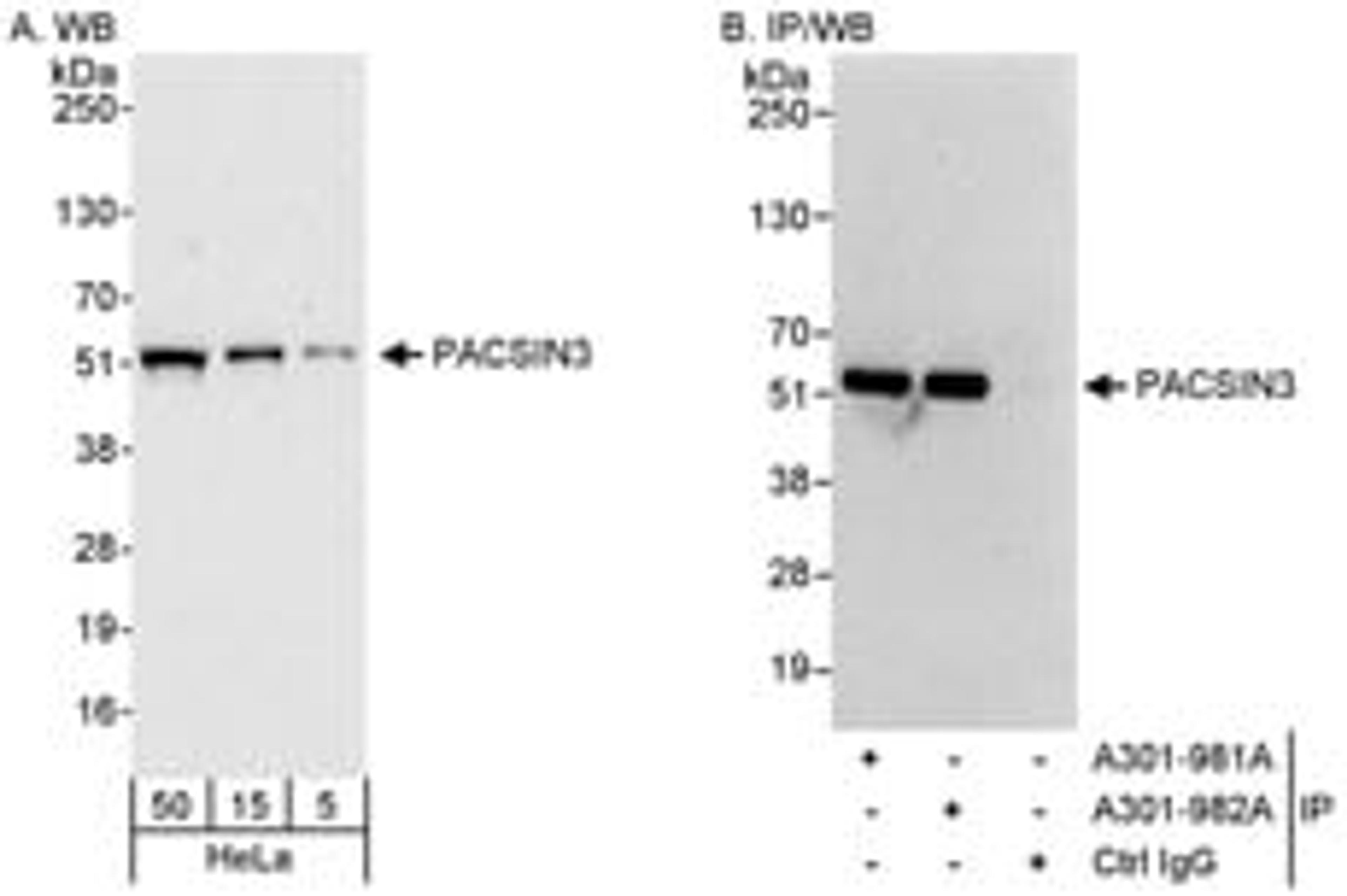 Detection of human PACSIN3 by western blot and immunoprecipitation.