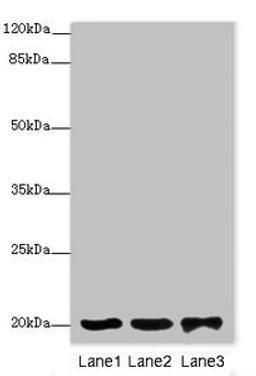Western blot. All lanes: FAIM antibody at 2ug/ml. Lane 1: 293T whole cell lysate. Lane 2: Rat gonad tissue. Lane 3: Jurkat whole cell lysate. Secondary. Goat polyclonal to rabbit IgG at 1/10000 dilution. Predicted band size: 21, 25, 23 kDa. Observed band size: 21 kDa. 