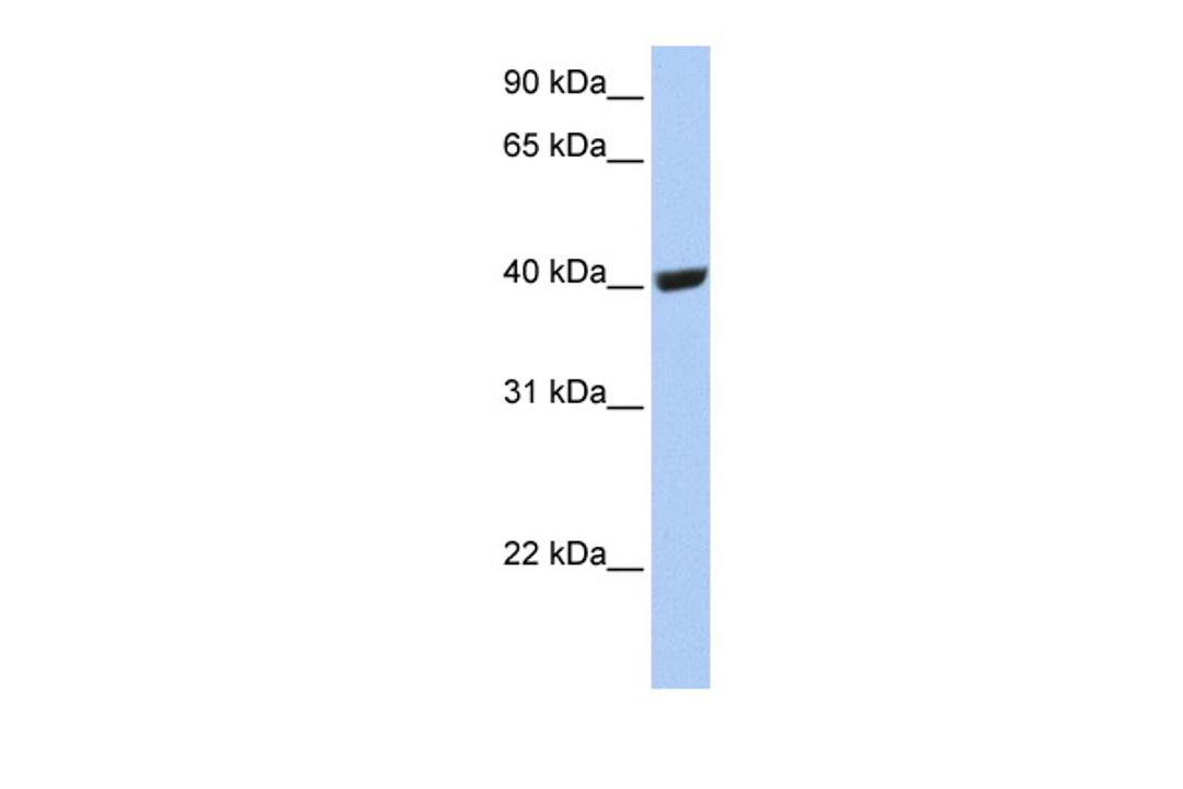 Antibody used in WB on Human 721_B at 0.2-1 ug/ml.