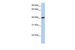 Antibody used in WB on Human 721_B at 0.2-1 ug/ml.