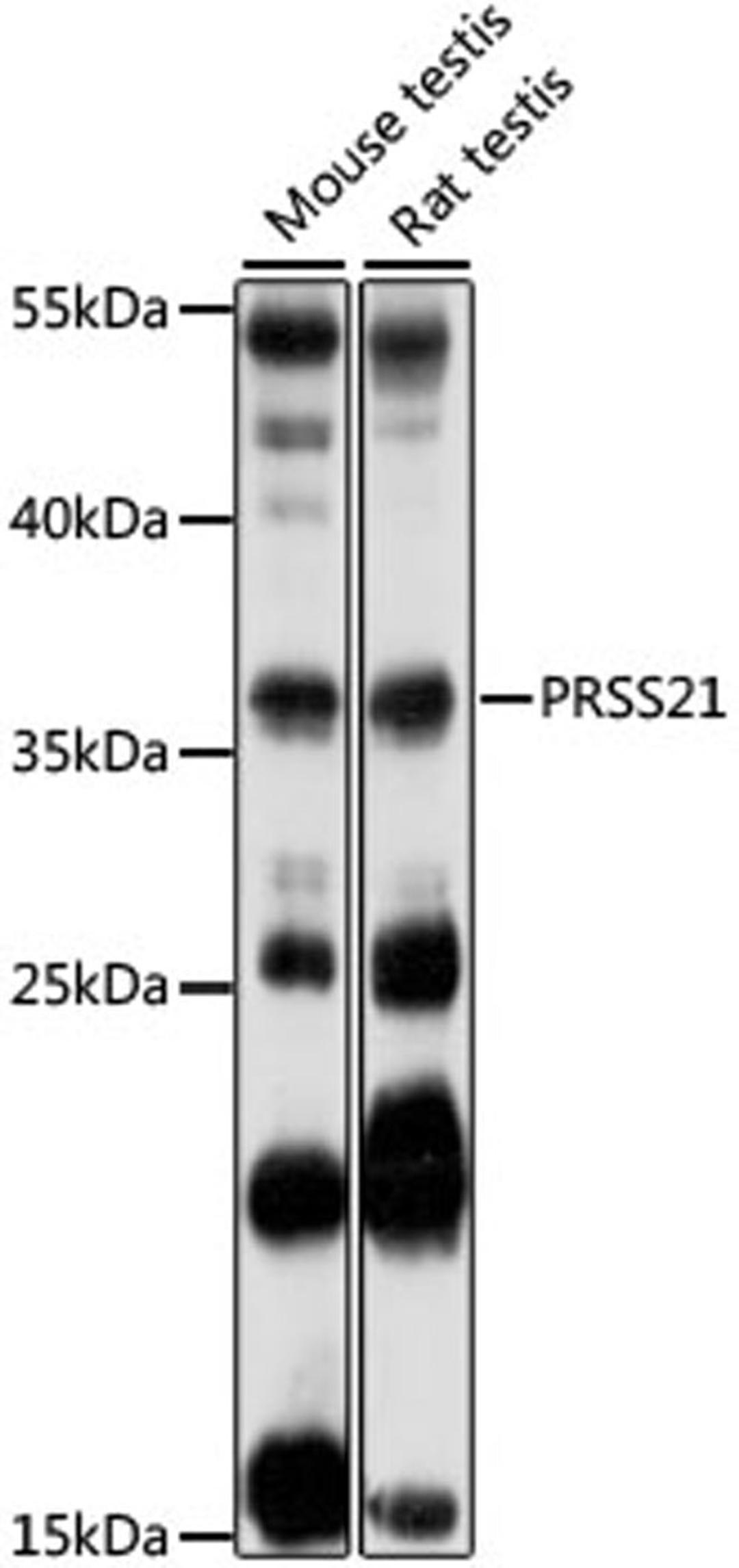 Western blot - PRSS21 antibody (A16100)