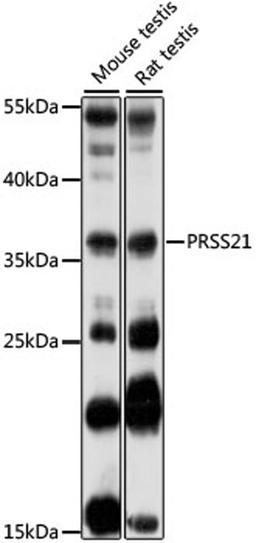 Western blot - PRSS21 antibody (A16100)