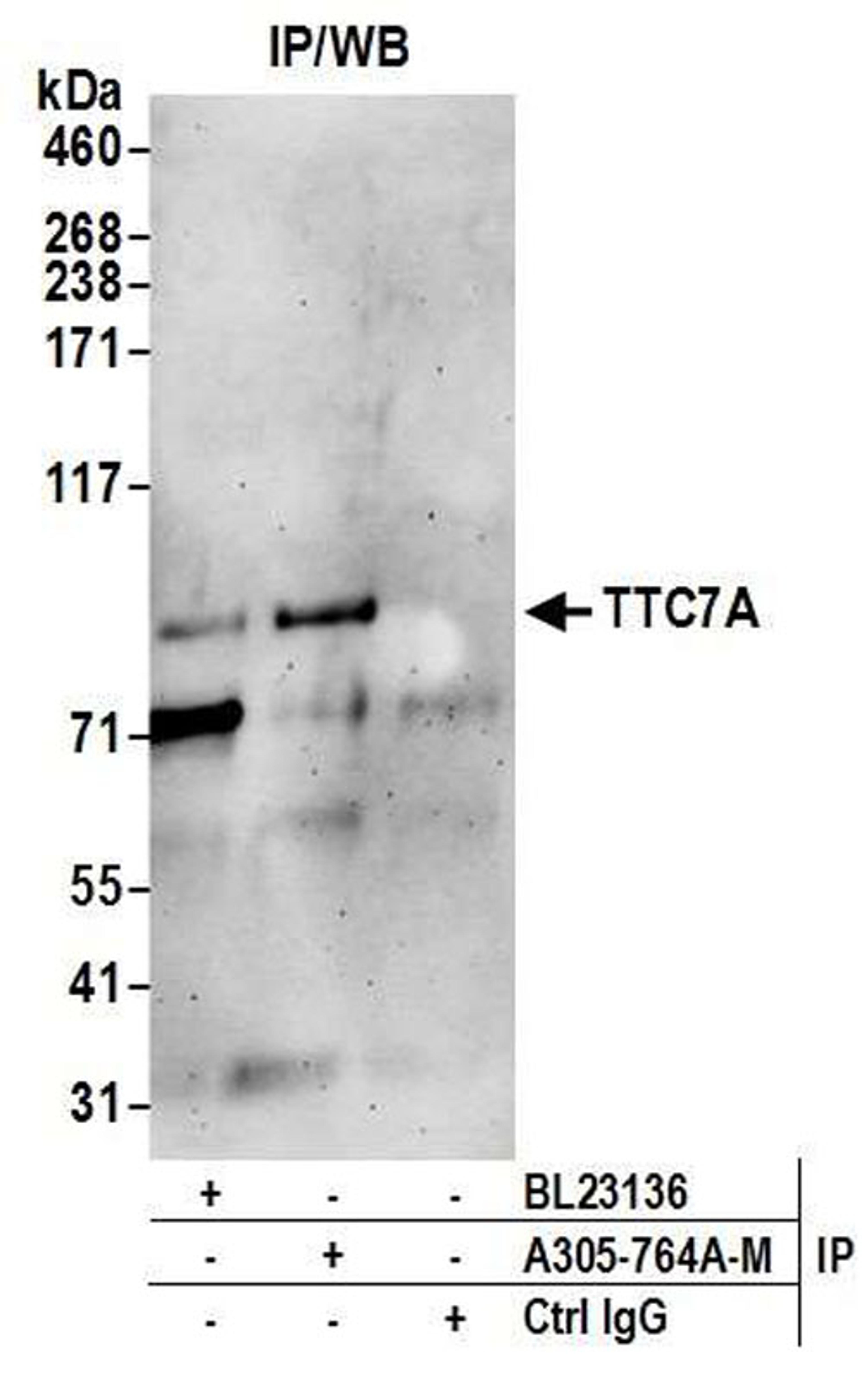 Detection of human TTC7A by WB of IP.