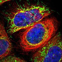 Immunocytochemistry/Immunofluorescence: MPST Antibody [NBP1-82617] - Staining of human cell line A-431 shows positivity in mitochondria.