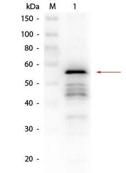 Western blot analysis of Alcohol Dehydrogenase yeast using Aldehyde Dehydrogenase antibody