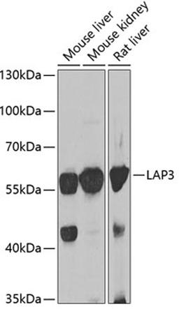 Western blot - LAP3 antibody (A7101)