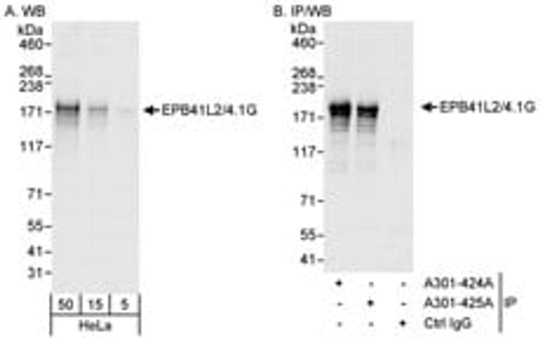 Detection of human EPB41L2/4.1G by western blot and immunoprecipitation.