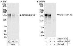 Detection of human EPB41L2/4.1G by western blot and immunoprecipitation.