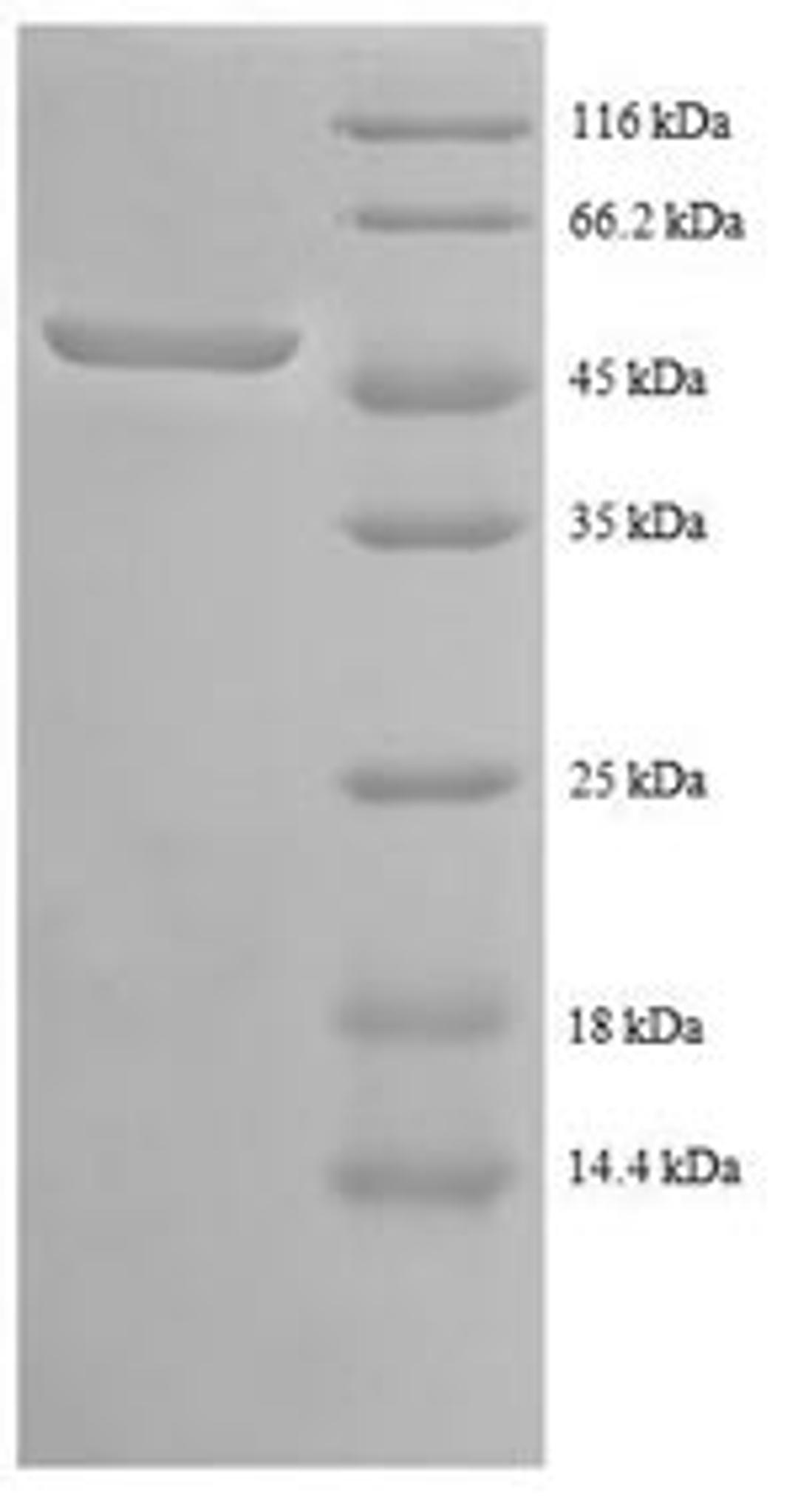 (Tris-Glycine gel) Discontinuous SDS-PAGE (reduced) with 5% enrichment gel and 15% separation gel.