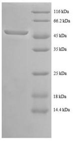 (Tris-Glycine gel) Discontinuous SDS-PAGE (reduced) with 5% enrichment gel and 15% separation gel.