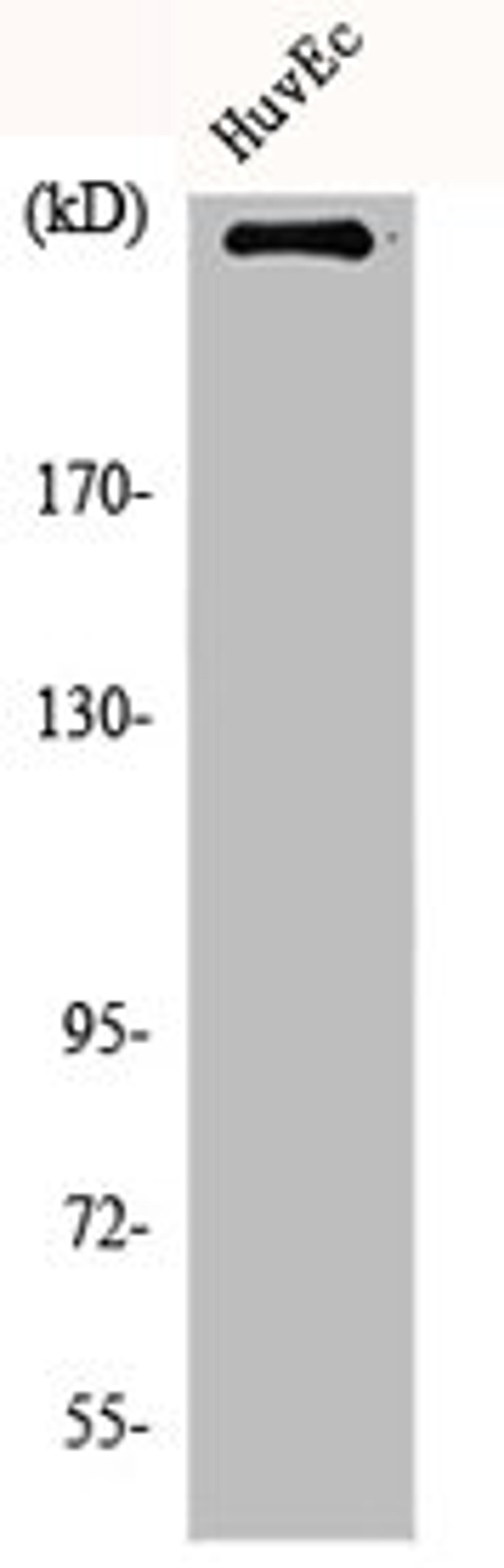 Western Blot analysis of HuvEc cells using mTOR Polyclonal Antibody