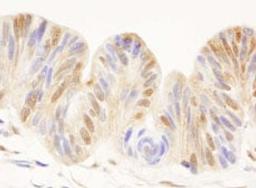 Detection of human CDC25c by immunohistochemistry.