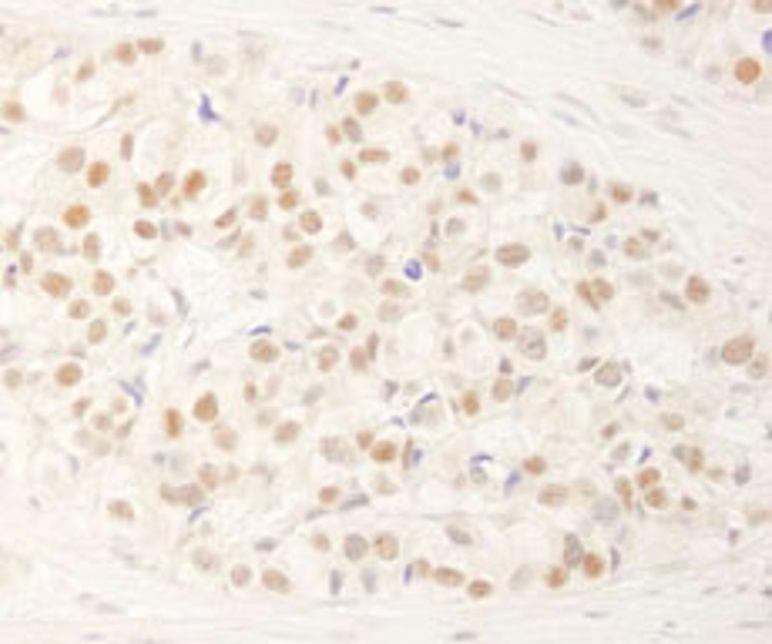 Detection of human NRBF2 by immunohistochemistry.