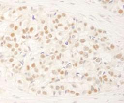 Detection of human NRBF2 by immunohistochemistry.