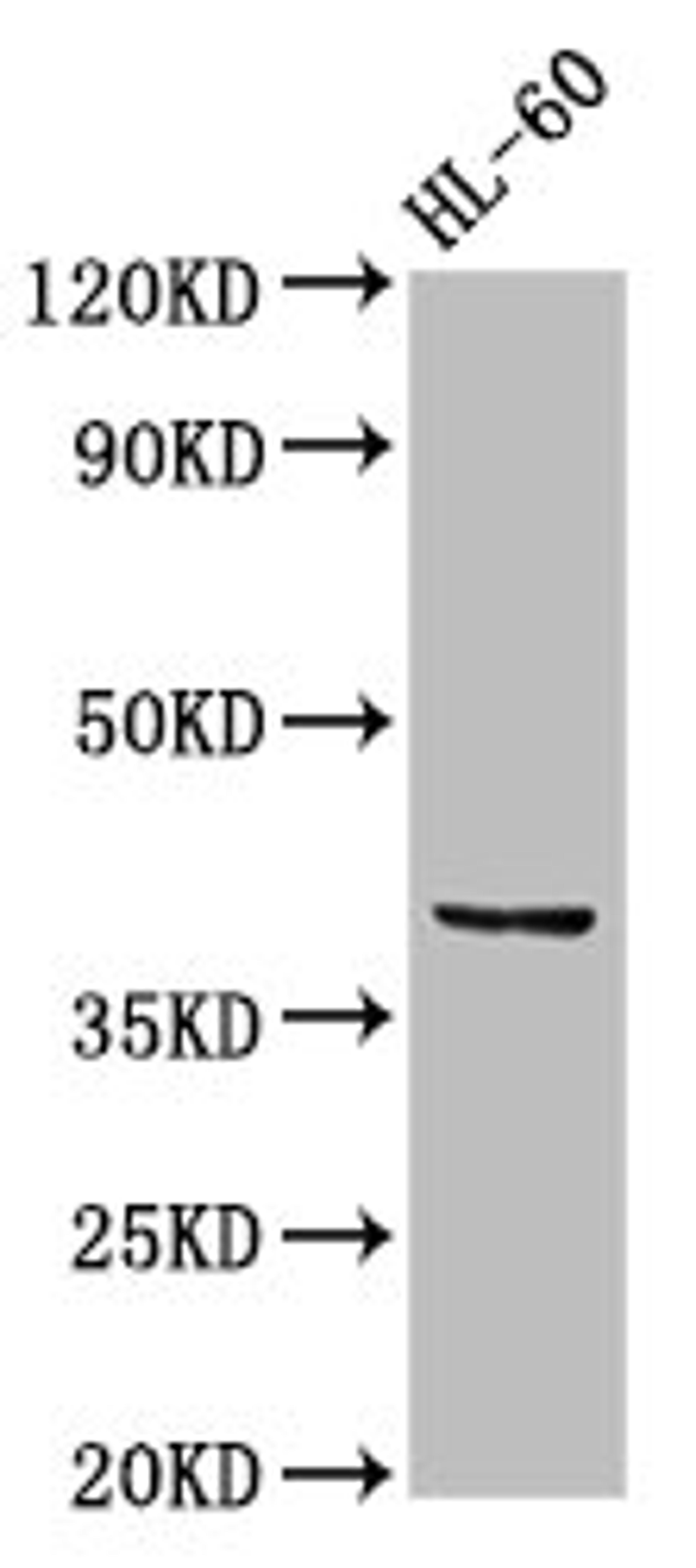 Western Blot. Positive WB detected in: HL60 whole cell lysate. All lanes: CCRL2 antibody at 2.5µg/ml. Secondary. Goat polyclonal to rabbit IgG at 1/50000 dilution. Predicted band size: 40, 41 kDa. Observed band size: 40 kDa