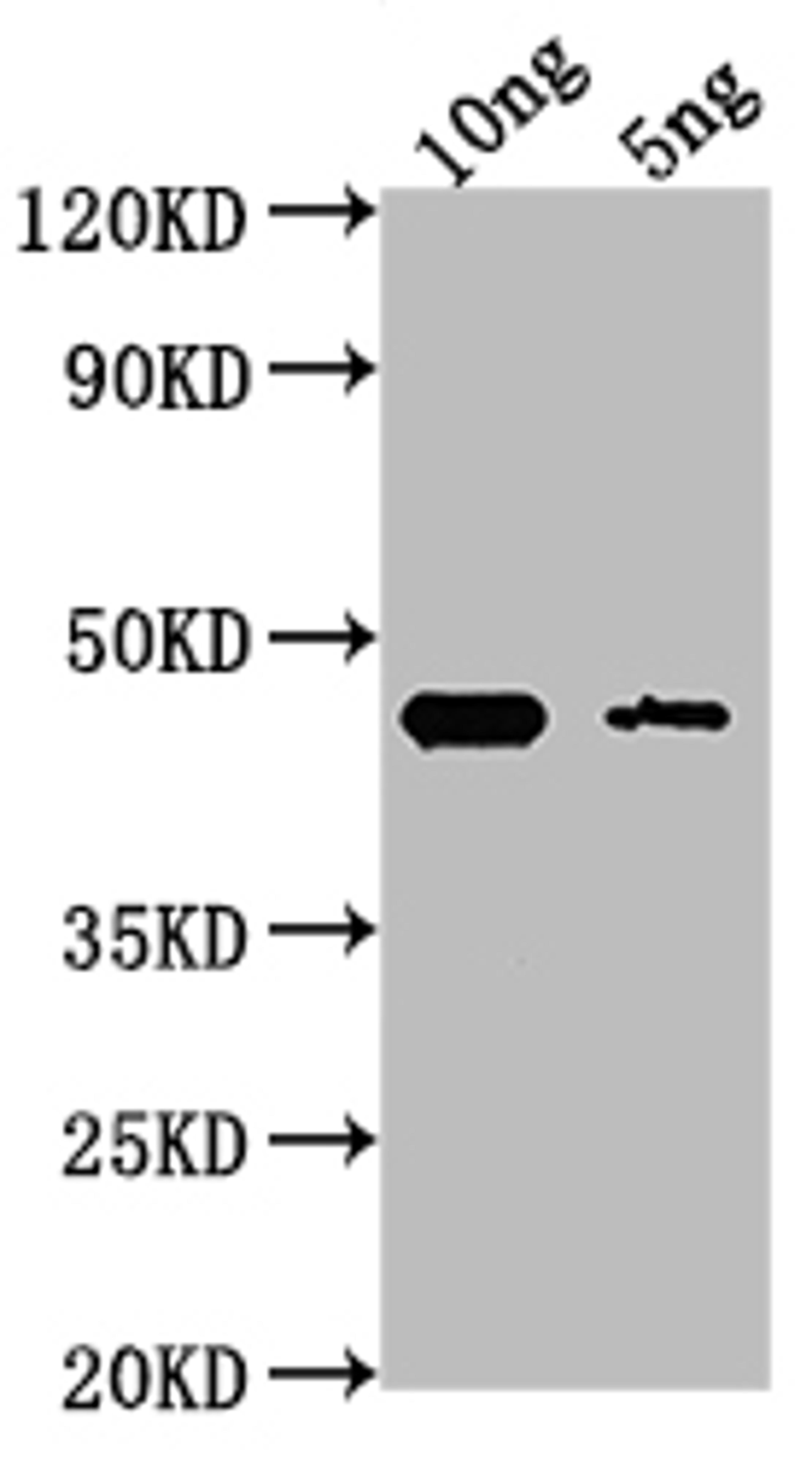 Western Blot. Positive WB detected in Recombinant protein. All lanes: GPM1 antibody at 1:2000. Secondary. Goat polyclonal to rabbit IgG at 1/50000 dilution. Predicted band size: 42.8 kDa. Observed band size: 44 kDa. 