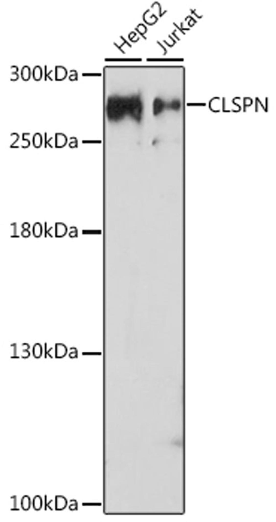 Western blot - CLSPN antibody (A17202)