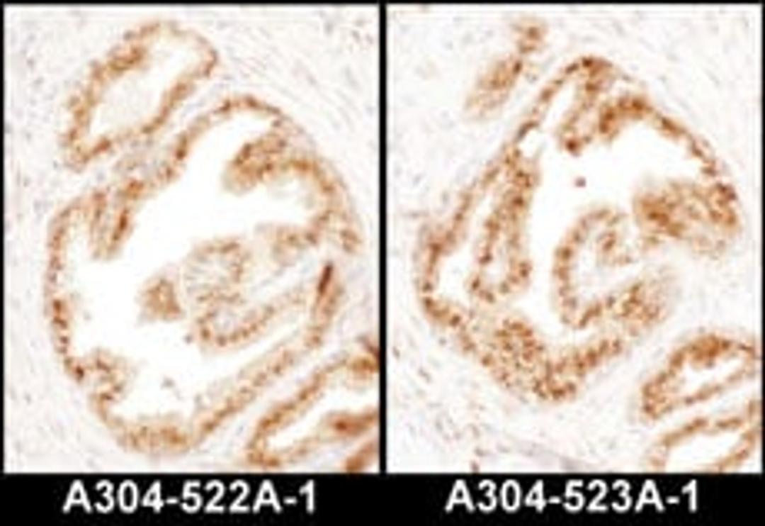 Detection of human COPB2 by immunohistochemistry.