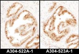 Detection of human COPB2 by immunohistochemistry.