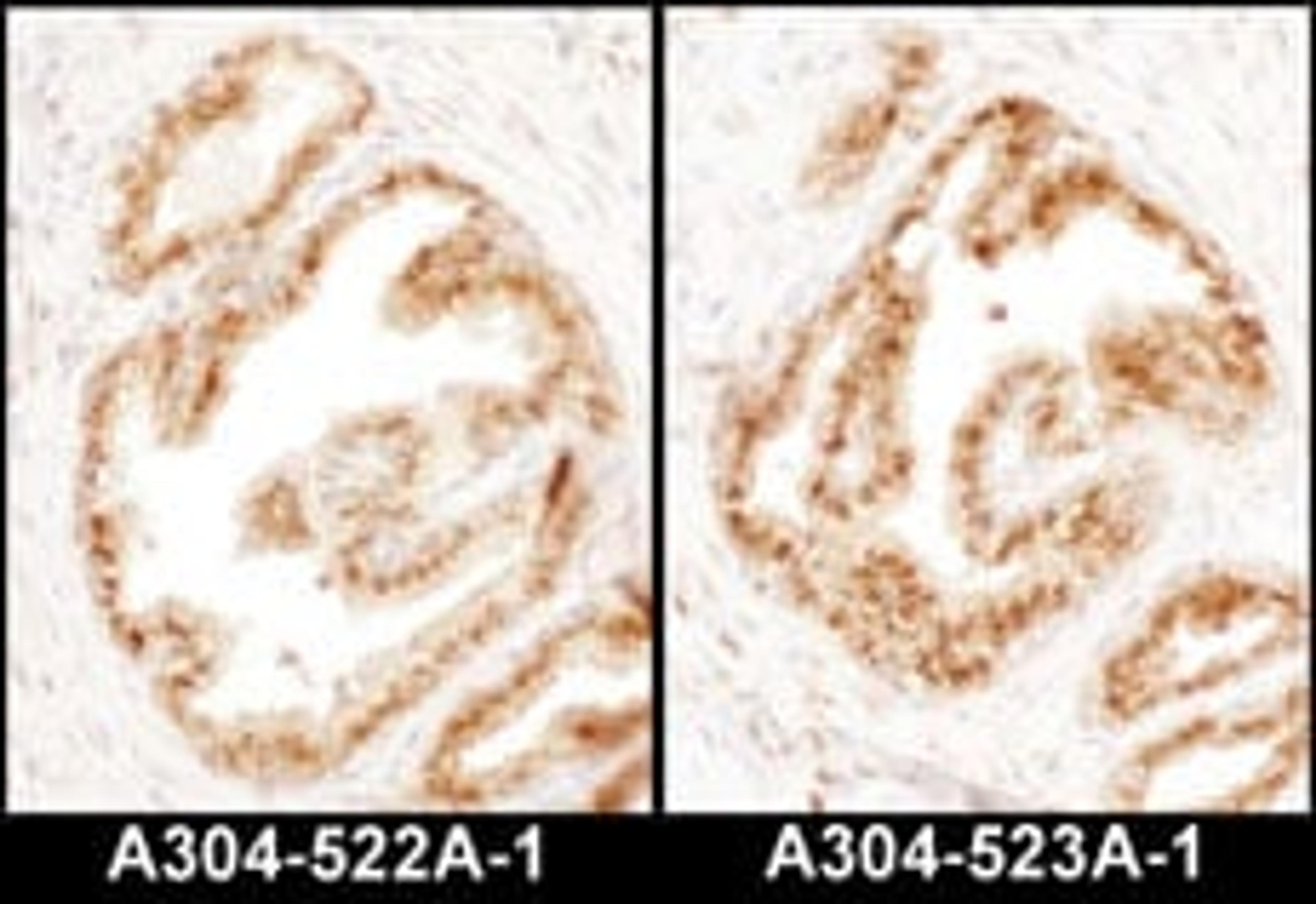 Detection of human COPB2 by immunohistochemistry.