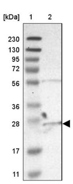 Western Blot: C6orf89 Antibody [NBP1-93921] - Lane 1: Marker [kDa] 230, 130, 95, 72, 56, 36, 28, 17, 11<br/>Lane 2: Human cell line RT-4