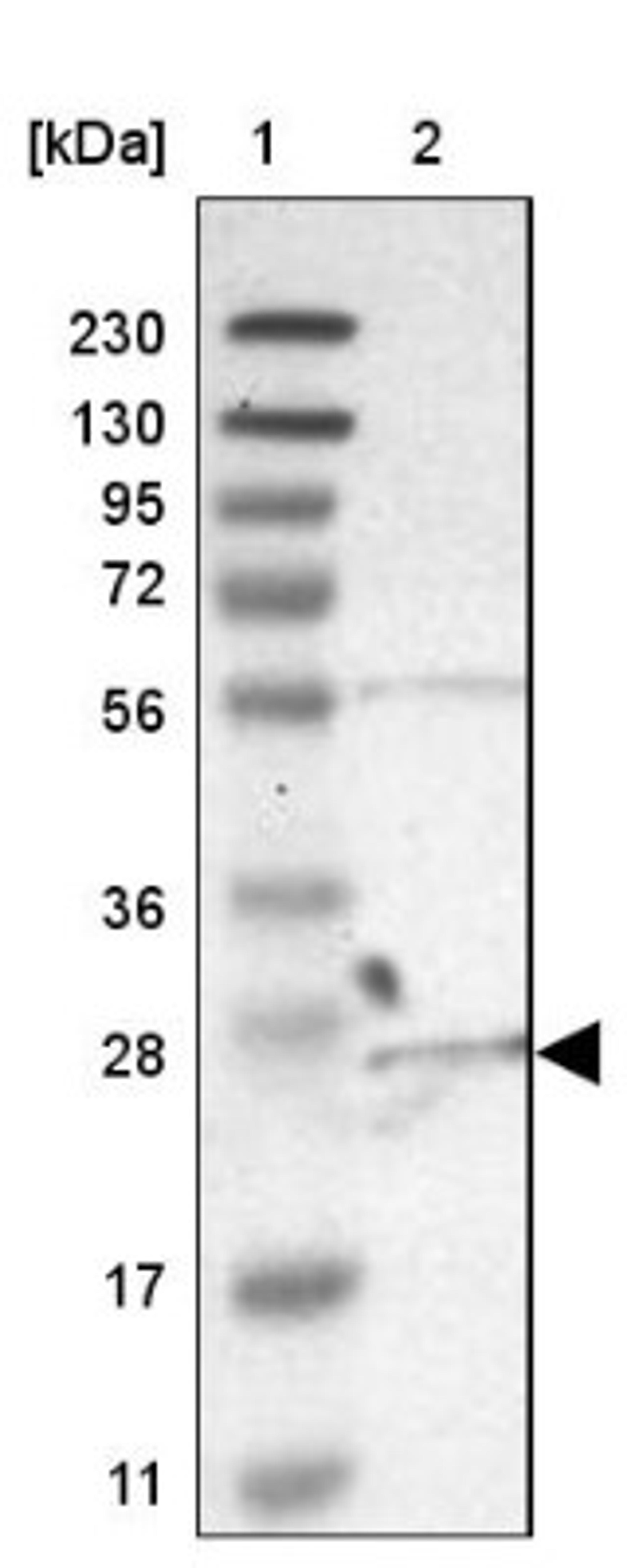 Western Blot: C6orf89 Antibody [NBP1-93921] - Lane 1: Marker [kDa] 230, 130, 95, 72, 56, 36, 28, 17, 11<br/>Lane 2: Human cell line RT-4